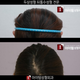 Illustration for article titled Round Head Plastic Surgery Seems Excessive, Even for South Korea